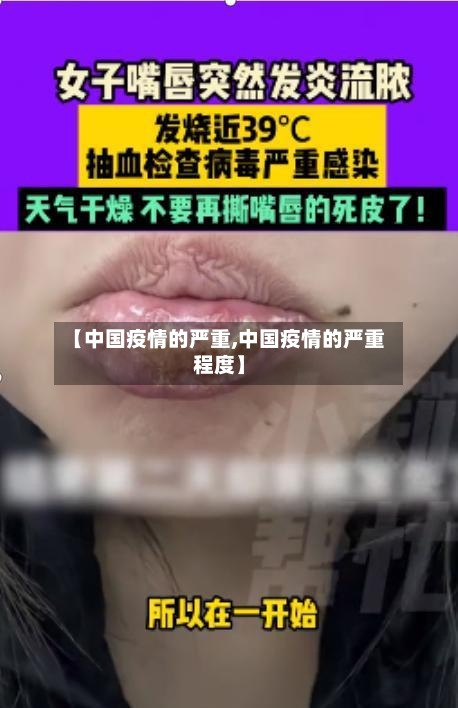 【中国疫情的严重,中国疫情的严重程度】-第1张图片